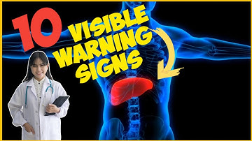 10 Visible Signs of Liver Disease You Should Never Ignore #liverhealth 