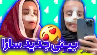 عمل بینیم 😍👃🏻