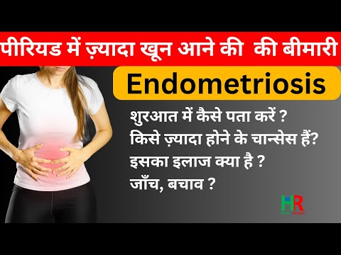 Video: Doktorens Diskussionsguide: Kan Det Vara Endometrios?