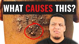What Causes Razor Bumps & Ingrown Hairs? A Barber Explains