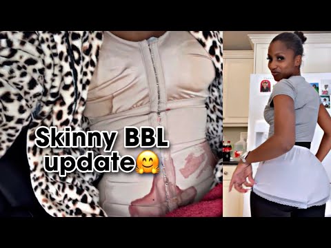 I GOT A SKINNY BBL (MOM OF 6) - YouTube