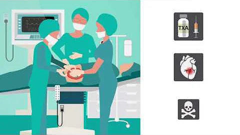 Perioperative Tranexamic Acid Treatment and Risk of Cardiovascular Events or Death After THA