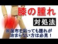 【膝痛】膝の腫れの対処法 超簡単ケア
