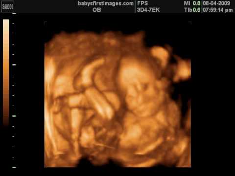 4d ultrasound pictures at 23 weeks 4d ultrasound pictures at 23 weeks
