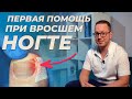 Как мгновенно убрать боль при ВРОСШЕМ НОГТЕ самостоятельно