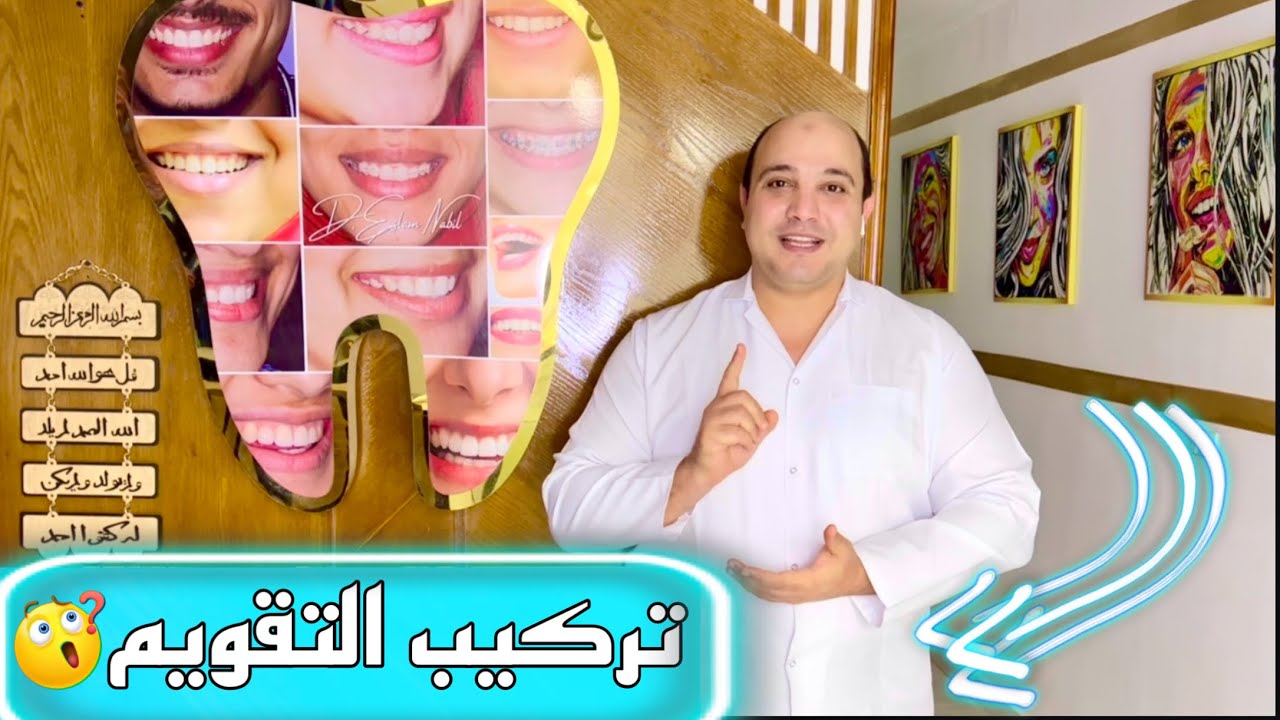 تركيب تقويم الأسنان فك واحد | ليه بعض الأسنان مش بنركب عليها | هل يتم تركيب التقويم في أول جلسه