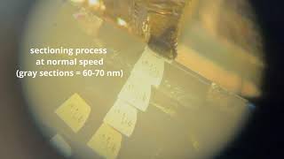 Ultrathin sectioning for transmission electron microscopy (TEM)