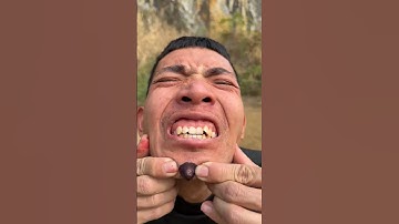 How I Cured a Bug Bite with Yogurtinthe Wild Survival Hacks🥳🥴#shorts