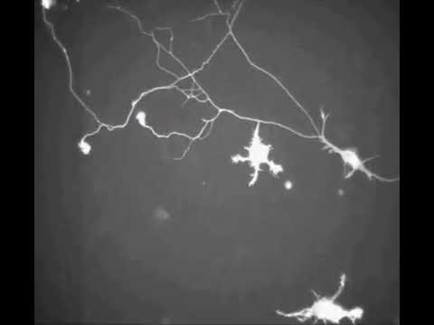 Brain cells forming new connections!