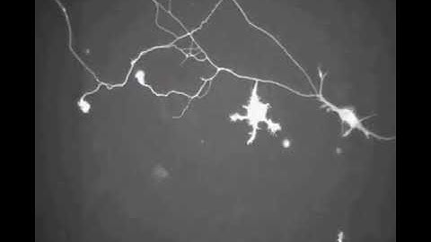 Brain cells forming new connections!