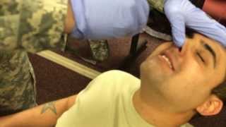 Nasopharyngeal airway insertion