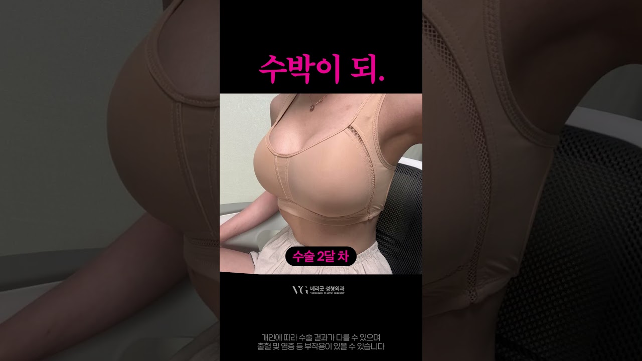 [Бэригүүд Гоо сайхны Мэс Заслын Эмнэлэг] Засваргүй бодит сэтгэгдэл. #хөхниймэсзасал #хөхтомруулах #хөхниймэсзасалсайнхийдэгэмнэлэг