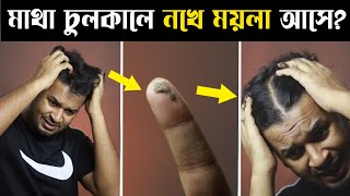 চুলের এই ময়লার কারনে আপনার মাথার চুল পরে যাচ্ছে কি । চুলের বিল্ডআপ সমস্যা । Remove Hair Buildup