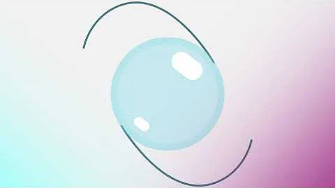 Light Adjustable Lens Post-Op Care