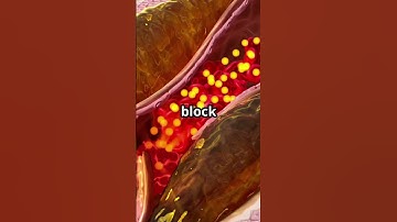 What Happens If You Surface Too Fast? 🤿 | Decompression Sickness Explained #shorts #medicaleducation