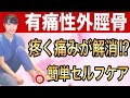 【外脛骨】じっとしていても疼く有痛性外脛骨の解消法