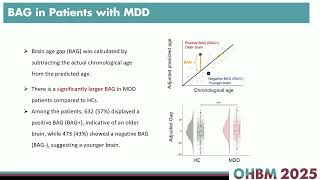 Famous OHBM 2025 | Oral Session | Chenxuan Pang | Brain age reveals heterogeneous lifespan development of… Profile