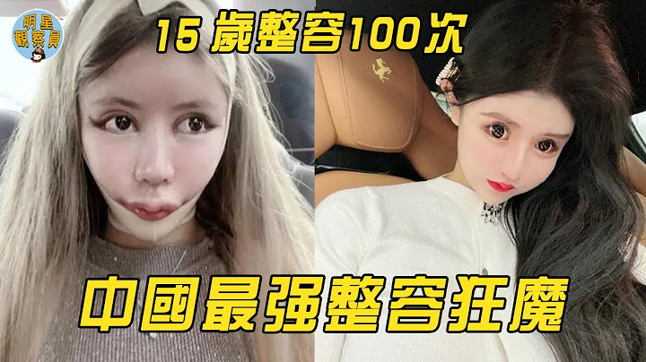 中国最强整容狂魔，2年整容100多次，一张脸换一辆法拉利！｜整容｜周楚娜｜明星观察员 - 天天要闻