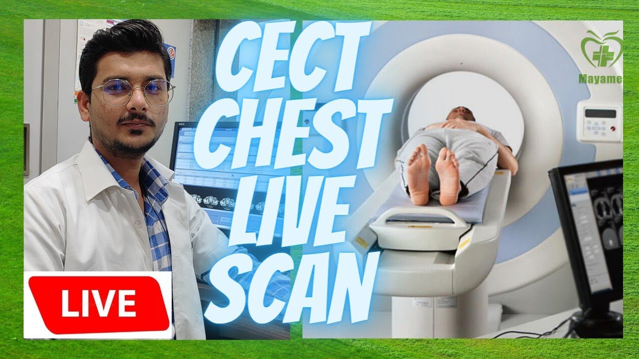 CECT CHEST LIVE SCAN CT SCAN CHEST CONTRAST SCANNING PROCESS ON GE