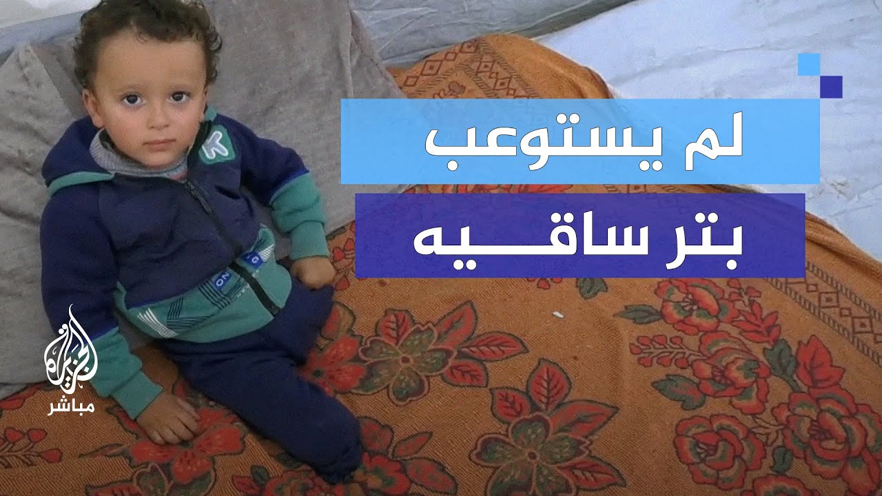 "بدنا نروح نجيب رجل".. طفل عمره 3 سنوات لم يستوعب بتر ساقيه
