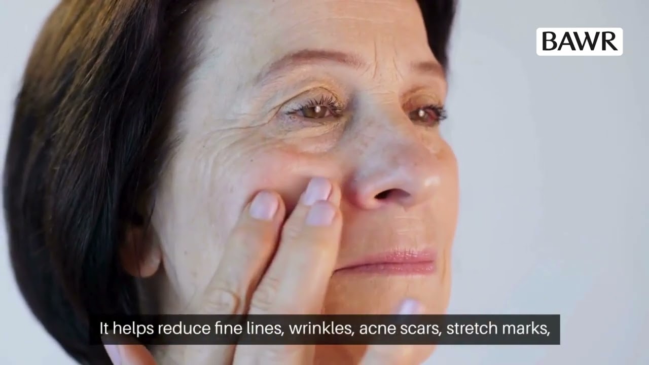 Microneedling in Dallas, TX | Timeline for Best Results