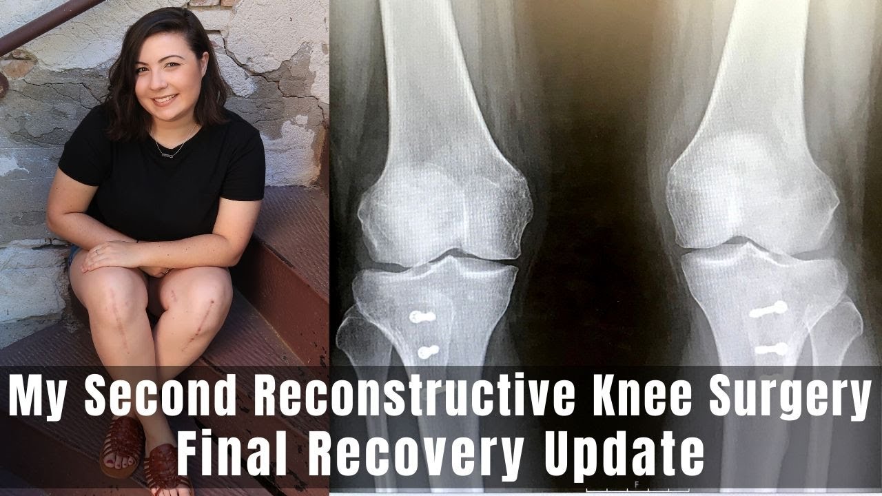 my-second-reconstructive-knee-surgery-final-recovery-update-tto