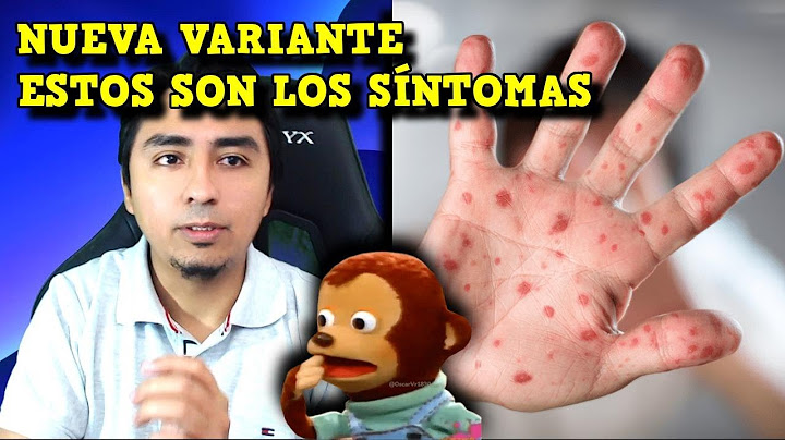 OTRA VEZ LA V1RUELA DEL MONO. Nueva Emergencia de Salud Global