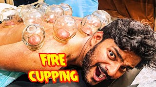 FIRE Cupping Karali 🔥😱 | Hijama Vlog😍 | Muscle Fitness💪 | Mishkat Khan | Therapy