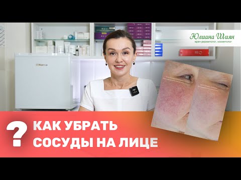 Купероз: причины возникновения и как его убрать? | Врач - дерматолог-косметолог Юлиана Шиян