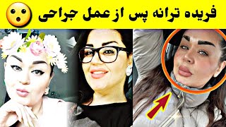 فریده ترانه اشتراک کننده قبلی ستاره افغان پس از جراحی صورت / tolo TV Farida Tarana