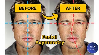 This Makes Your Face Asymmetrical / Unattractive (blackpill)