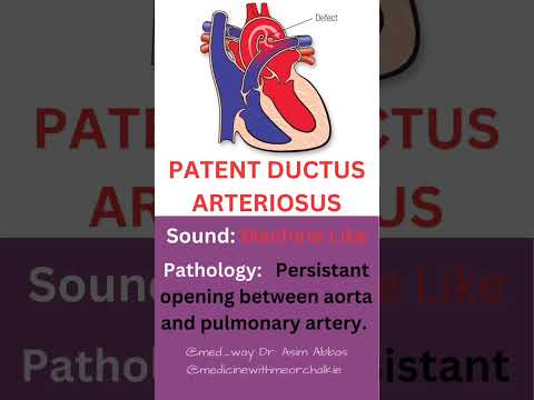 HEART SOUNDS PART 3 #heartsounds #heartsound #cardiology