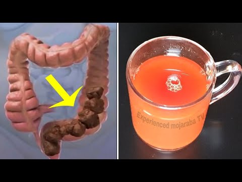 How to detoxify the intestines (colon) through natural home remedies?  Experienced