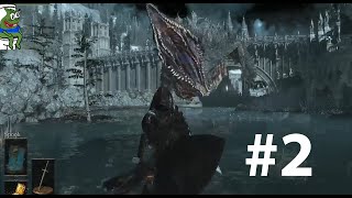 Retard doesnt fucking die #2