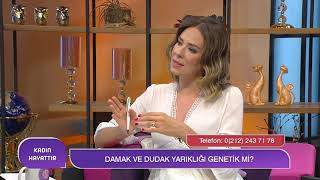 Bebekte Yarık Dudak ve Damak Rahatsızlığı Nasıl Tedavi Edilir? | Prof. Dr. Semra Karşıdağ