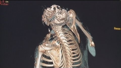 euronews hi-tech - Virtopsies revolutionise the morgue