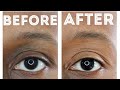 FULLY COVER DARK CIRCLES/EYELIDS and color correct