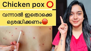 Chicken pox 🛑 വന്നാൽ ഇതൊക്കെ ശ്രദ്ധികണം ⭕️/#chickenpox #vlog