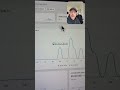 Product test day 3, lets start scaling!
