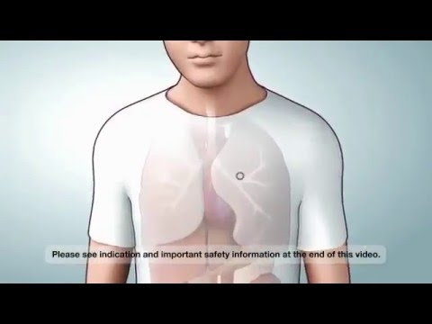 Medical Narration: KALYDECO™ ivacaftor:  Voice Over by Rory O&rsquo;Shea