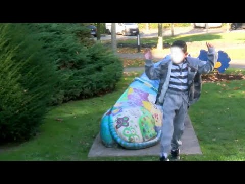 أطباء في ألمانيا ينقذون حياة الطفل الفراشة