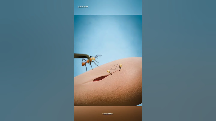 Using Ants To Stitch Wounds!