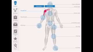 TherexRx App Preview (Therapeutic Exercise Prescription)