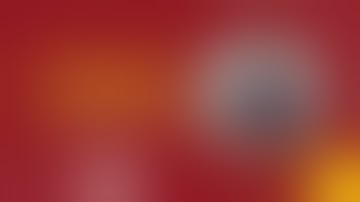 Posterolateral Condyle # Y/E Tibia Direct Posterolateral Approach - Dr Jignesh Pandya