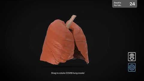 COVID Lung 3D Slicer Demo