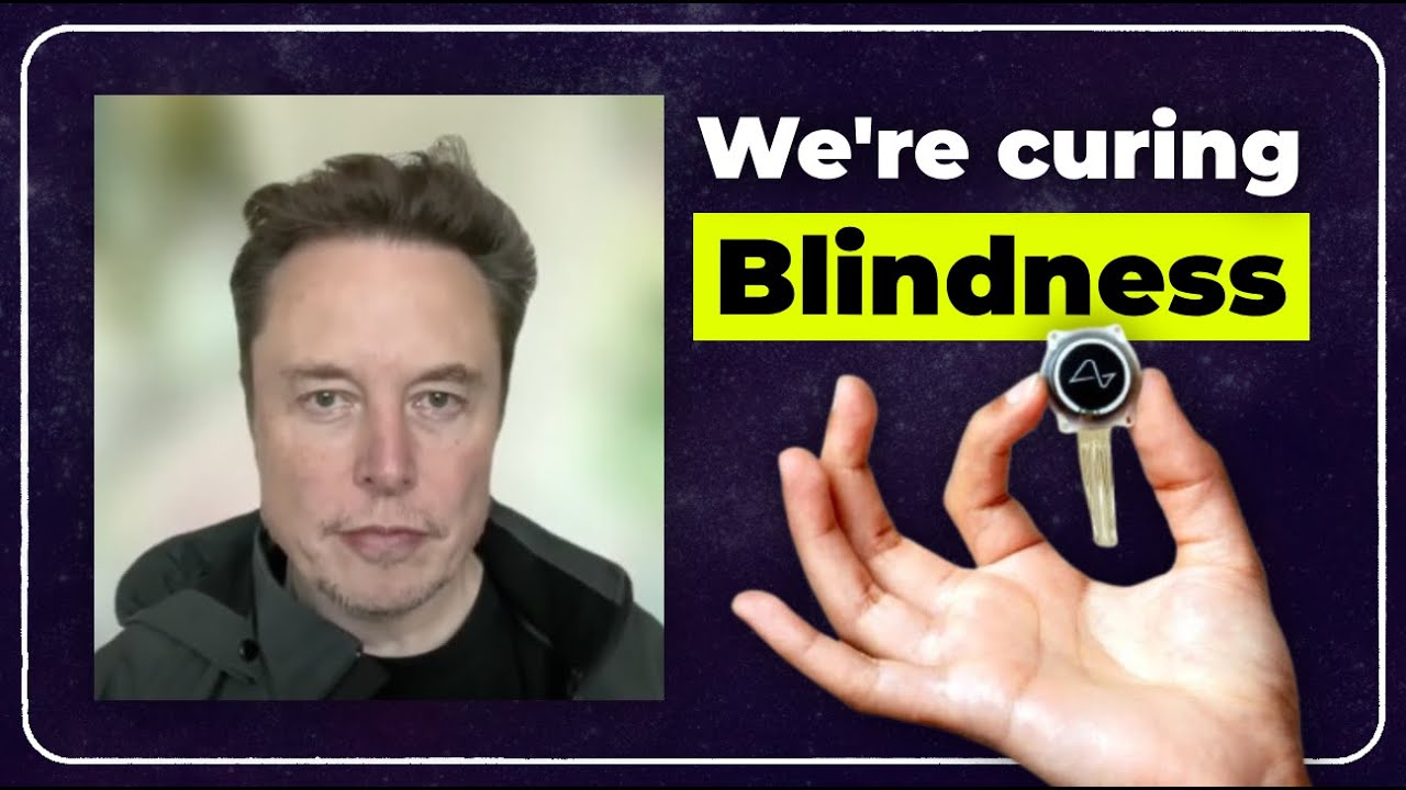 Elon musk gives Neuralink talk at the Congress of Neurological Surgeons: Full Interview 2024