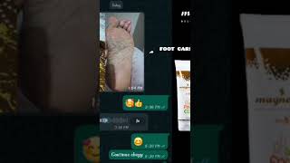 footcare customer feedback???? know more commmentbox??