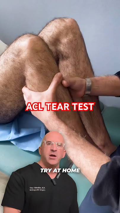 Quick DIY ACL Tear Test 🦵 Try at Home! #shorts