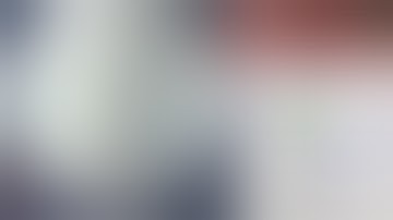 Minimally Invasive Proximal Tibia Plating  #pallawihospital #mancherial #orthopaedicsurgeon