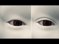 How Double Eyelid Surgery Works How Double Eyelid Surgery Works